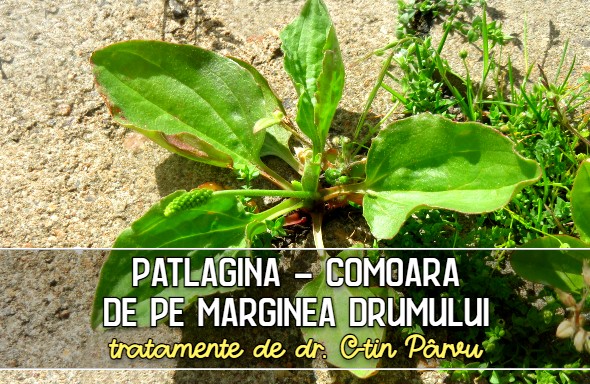Patlagina - tratamente recomandate de dr. C-tin Parvu