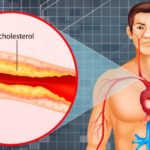 Adevarata cauza a colesterolului crescut din sange