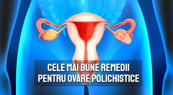 Cele mai bune remedii pentru sindromul ovarelor polichistice - dr. Jin Sung