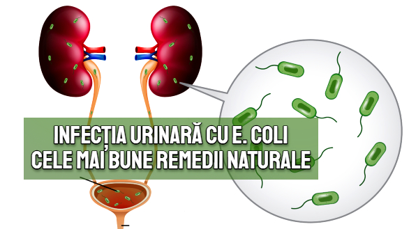 Infectia urinară cu E. coli – cele mai bune remedii naturale