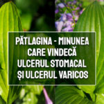 Patlagina - minunea care vindeca ulcerul stomacal si ulcerul varicos
