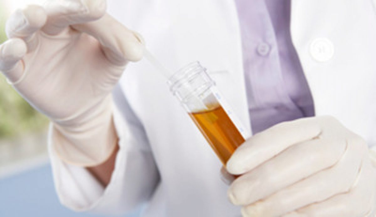 Este posibilă determinarea prostatitei din urină și teste de sânge
