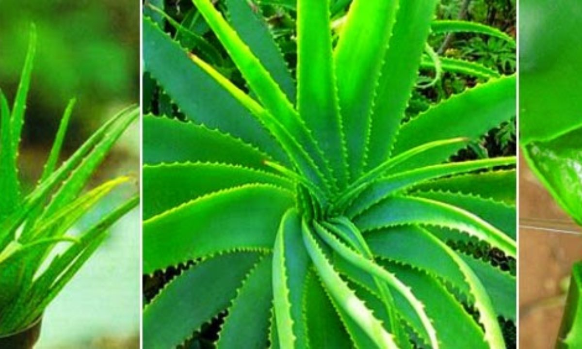 Tratamentul cu Aloe vera - Varice