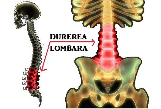 tratament homeopatic al coloanei vertebrale artroza umar simptome