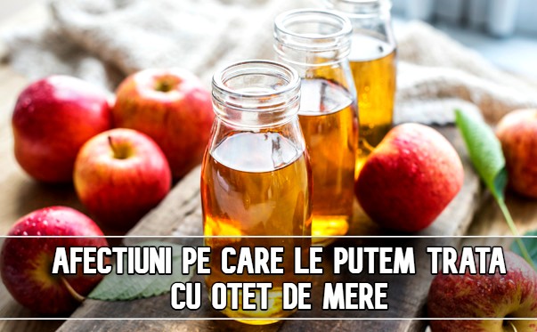 Afectiuni pe care le putem trata cu otet de mere