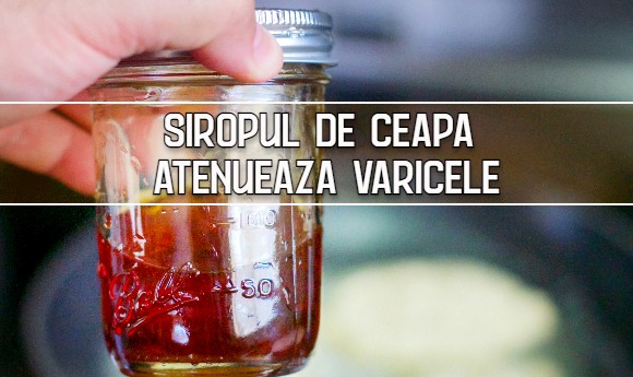 Siropul de ceapa atenueaza varicele