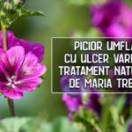 Picior umflat cu ulcer varicos – tratament naturist recomandat de Maria Treben