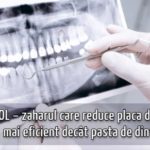 Xilitol – zaharul care reduce placa dentara mai eficient decat pasta de dinti