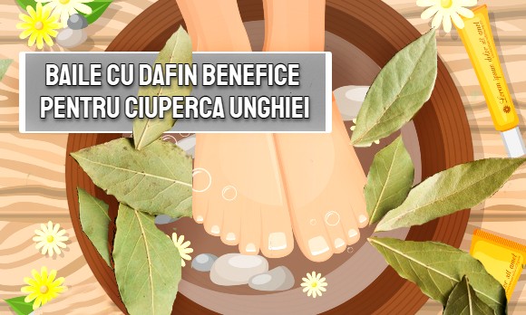 ulei de dafin pentru ciuperca unghiilor)
