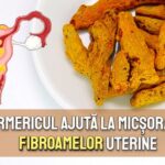 Turmericul ajuta la micsorarea fibroamelor uterine