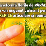 Transforma florile de papadie intr-un unguent calmant pentru durerile articulare si reumatice