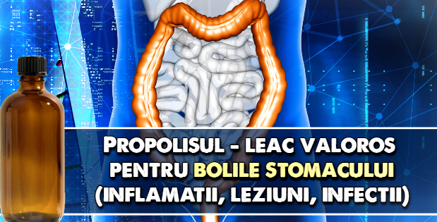 Propolisul – leac valoros pentru afectiunile stomacului - inflamatii, leziuni, infectii