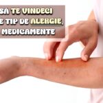 Cum sa te vindeci de alergii fara medicamente