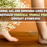 Singurul gel din România care previne și tratează varicele, venele varicoase – dovedit științific