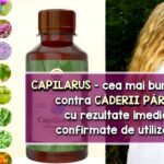 Lotiune contra caderii parului